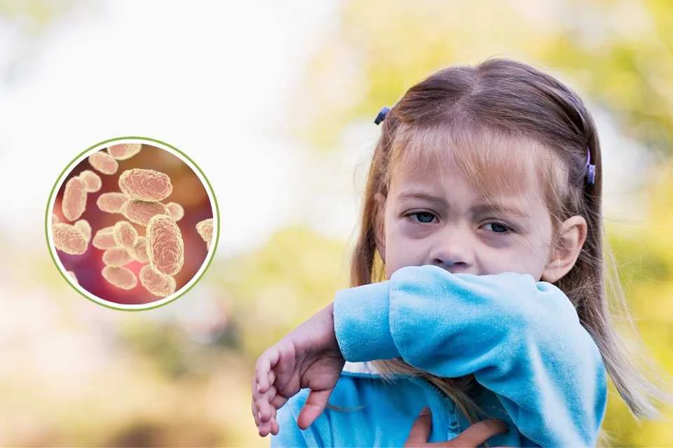 Preocupacion-por-altos-contagios-de-coqueluche